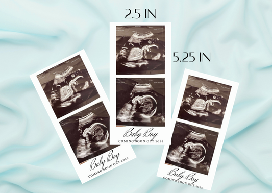 Baby Ultrasound Photo Magnets - Pregnancy Announcement Keepsake
