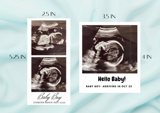 Baby Ultrasound Photo Magnets - Pregnancy Announcement Keepsake