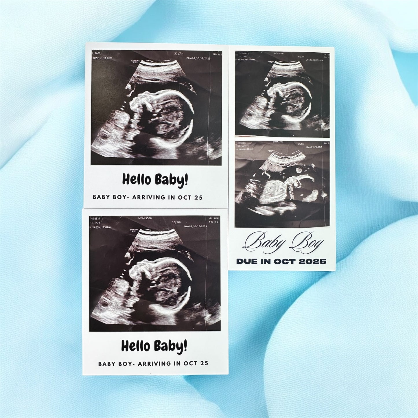 Baby Ultrasound Photo Magnets - Pregnancy Announcement Keepsake