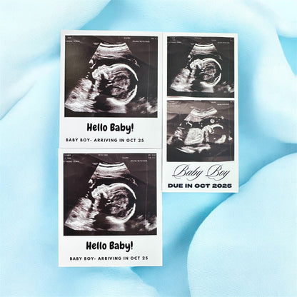 Baby Ultrasound Photo Magnets - Pregnancy Announcement Keepsake