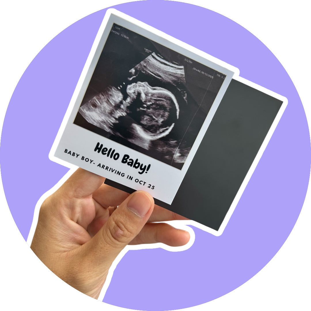 Baby Ultrasound Photo Magnets - Pregnancy Announcement Keepsake