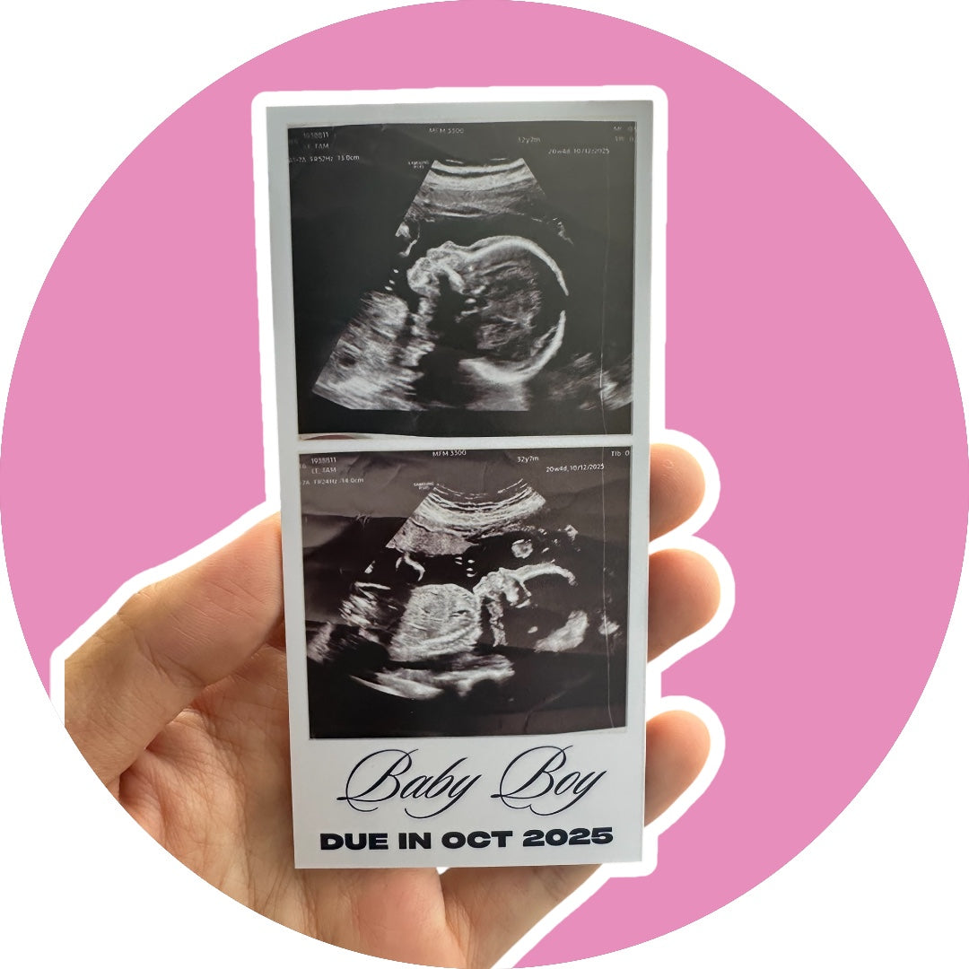 Baby Ultrasound Photo Magnets - Pregnancy Announcement Keepsake