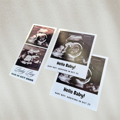 Baby Ultrasound Photo Magnets - Pregnancy Announcement Keepsake